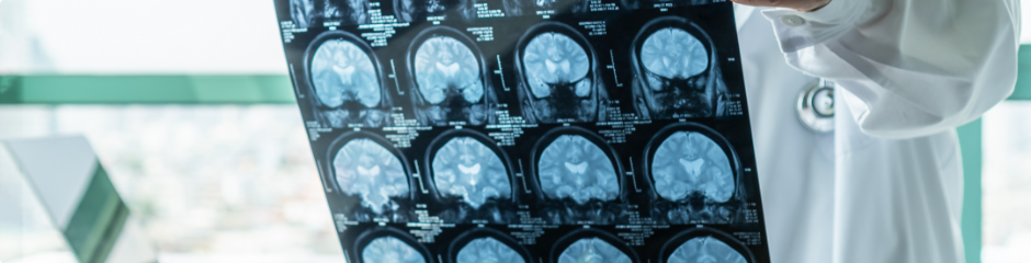 Neurosciences